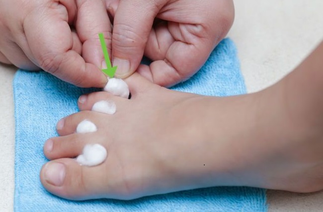 Putting cotton balls in between your toes